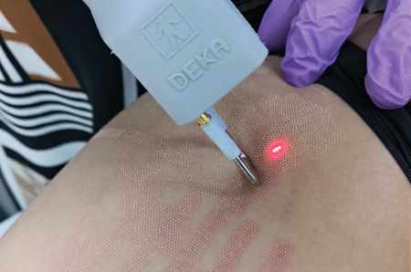 How Can I Stop My Stretch Marks From Growing?